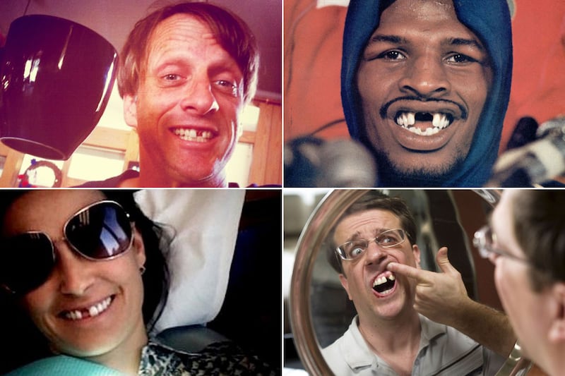 galleries/2011/08/26/toothless-celebrity-smiles-tony-hawk-demi-moore-jim-carrey-more-photos/toothless-smiles-tease_tpvtvb