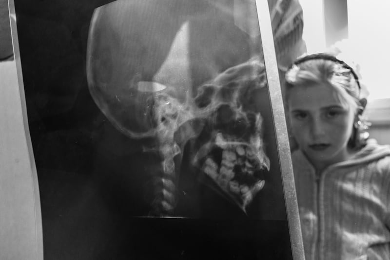 articles/2013/11/29/the-little-syrian-girl-with-a-bullet-in-her-head/131127-beals-syria-tease_px0buu