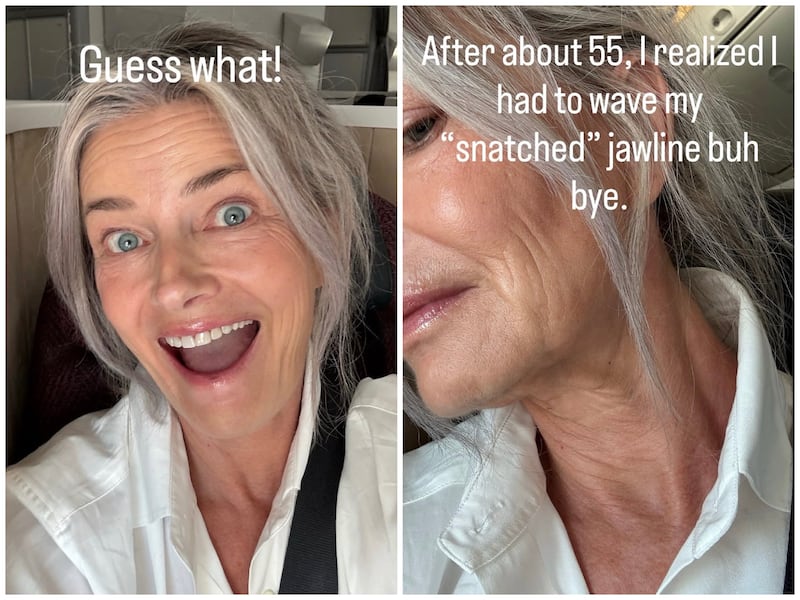 Paulina Porizkova said her jawline began to soften after she turned 55.