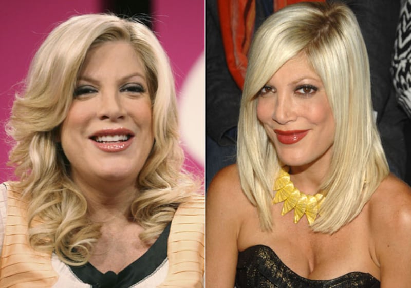 galleries/2010/01/09/celebrity-weight-loss/celebrity-weight-loss---tori-spelling_wbhlsv