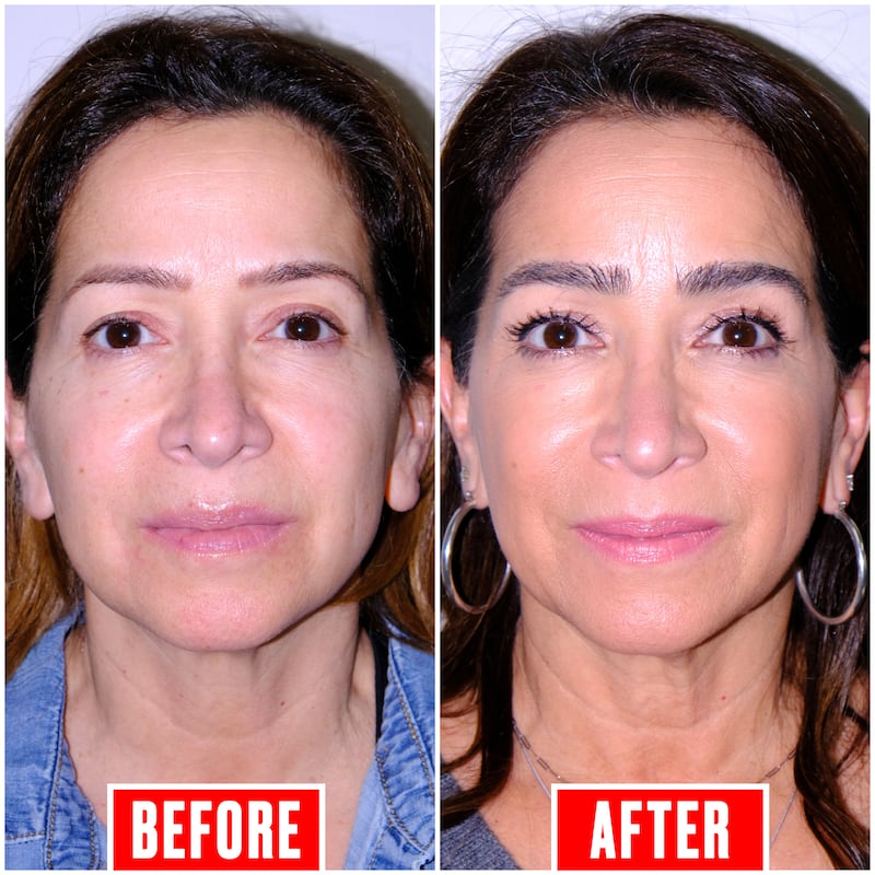 Eyebrow Tranformation