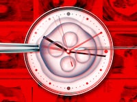 A photo illustration of IVF, sonograms, and a clock.