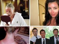 galleries/2011/07/04/celebrity-sunburns-kim-kardashian-simon-cowell-and-more/tease-worst-celebrity-sunburns_qolml2