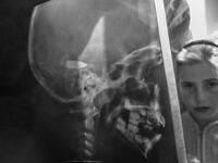 articles/2013/11/29/the-little-syrian-girl-with-a-bullet-in-her-head/131127-beals-syria-tease_f1trnr