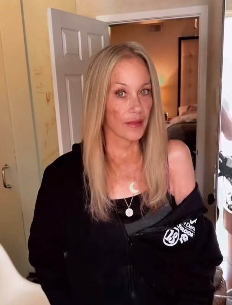 Christina Applegate delighted fans when she returned to Instagram in September after a long break by posting a video of herself posing for the camera. In the caption, she wrote, “Fresh hair color, new weird spot on my cheek haha."