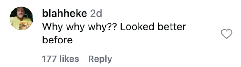 Many commenters disagreed with Alli Dore's decision to undergo rib remodeling surgery.