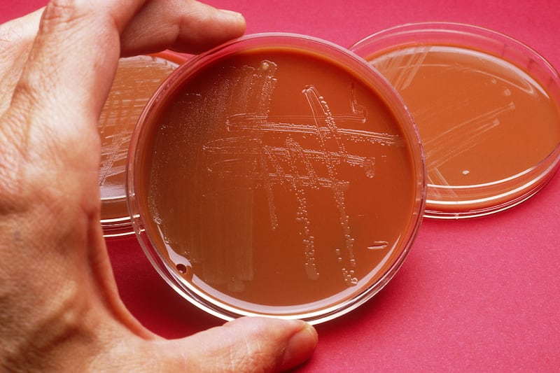 articles/2013/05/07/drug-resistant-gonorrhea-the-sex-superbug-is-not-worse-than-aids/130506-Sepkowitz-Gonorrhea-tease_kslmdw
