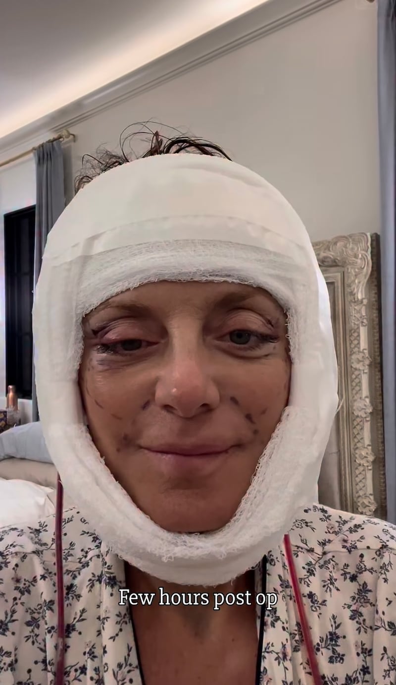 Kathy Wakile posted an Instagram video just hours after her multiple plastic surgeries.