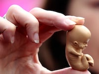 articles/2014/09/09/a-christian-case-for-abortion-rights/140908-goff-abortion-tease_vpaivz