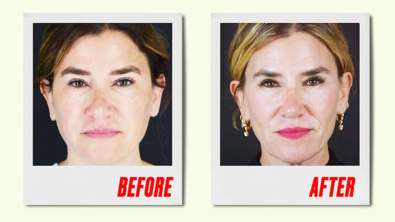 A photo illustration of Sarmela Sunder before and after for Looker.