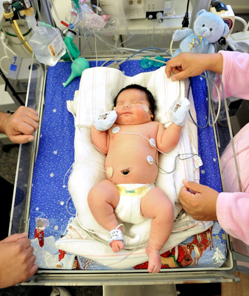 galleries/2011/07/12/world-s-biggest-babies/richard-sault-big-babies_schkjz