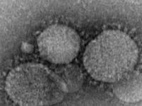 articles/2013/05/31/please-pay-attention-to-the-mers-warnings/130531-mers-virus-tease_vyrgmd