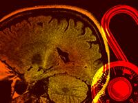 articles/2017/01/31/computer-lets-fully-paralyzed-patients-speak-for-first-time/170130-Azarian-als-lock-tease_hxuree