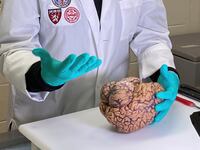 Dr. Ann McKee, Chief of Neuropathology, VA Boston examines the brain of a 47-year old former college football player looking for signs of CTE in Boston.