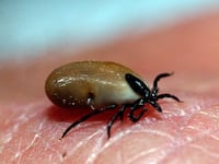 articles/2014/04/02/cases-of-new-tick-borne-illness-heartland-virus-grow/140401-sepkowitz-disease-tease_vt1ppw