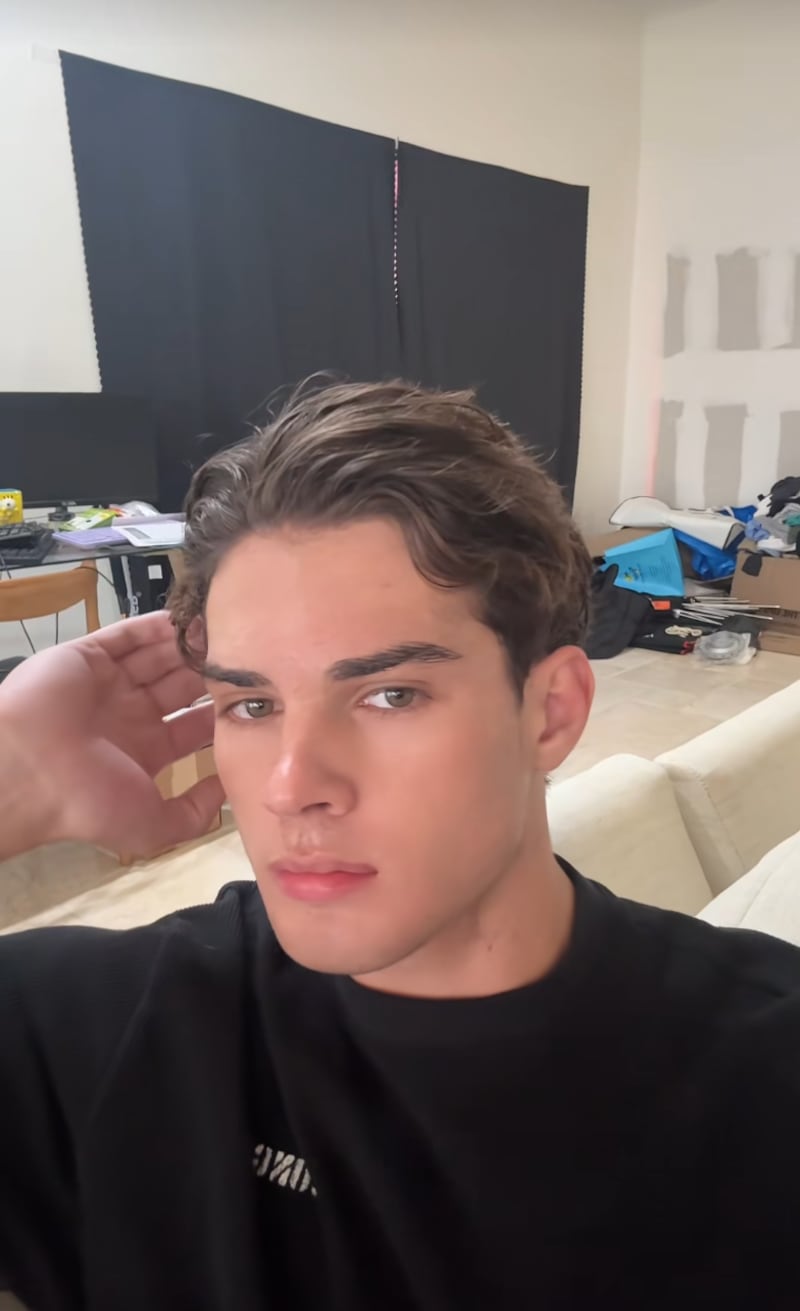 Clavicular influencer undergoes nose job