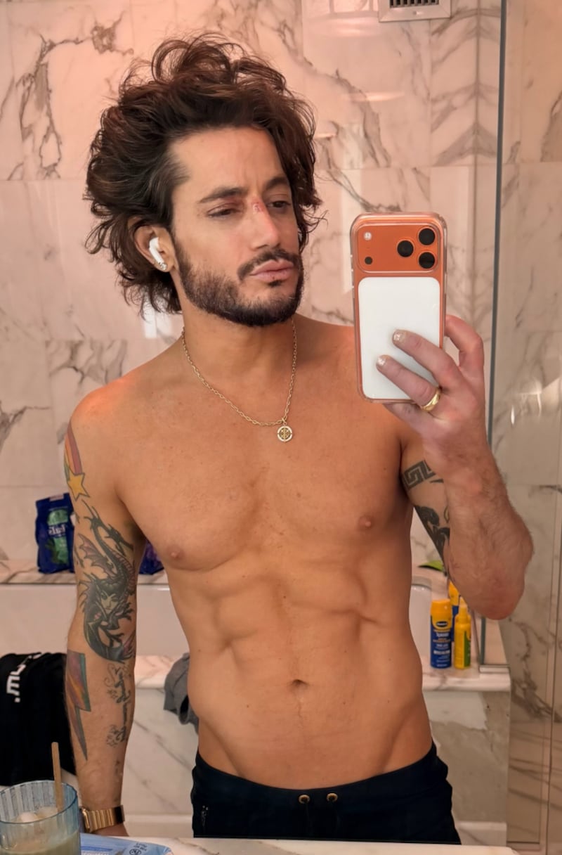 Frankie Grande poses in a mirror selfie after being hit with a prop on the nose during a Broadway performance.
