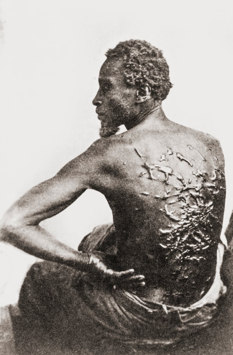 Photo showing The scarred back of an African-American slave named Gordon who escaped from Mississippi and reached a Union Army camp in Louisiana in 1863.
