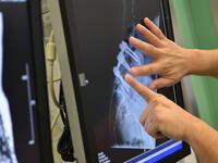 articles/2014/11/03/patients-screwed-in-spine-surgery-scam/141102-cir-medical-scam-tease_mukxv0