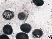articles/2012/09/28/new-york-s-meningococcus-scare-outbreak-in-gay-community/meningitis-gay-community-sepkowitz_jqazkg