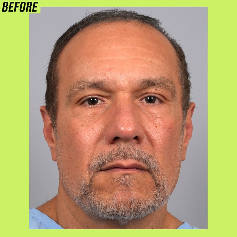 Male hair transformation before and after