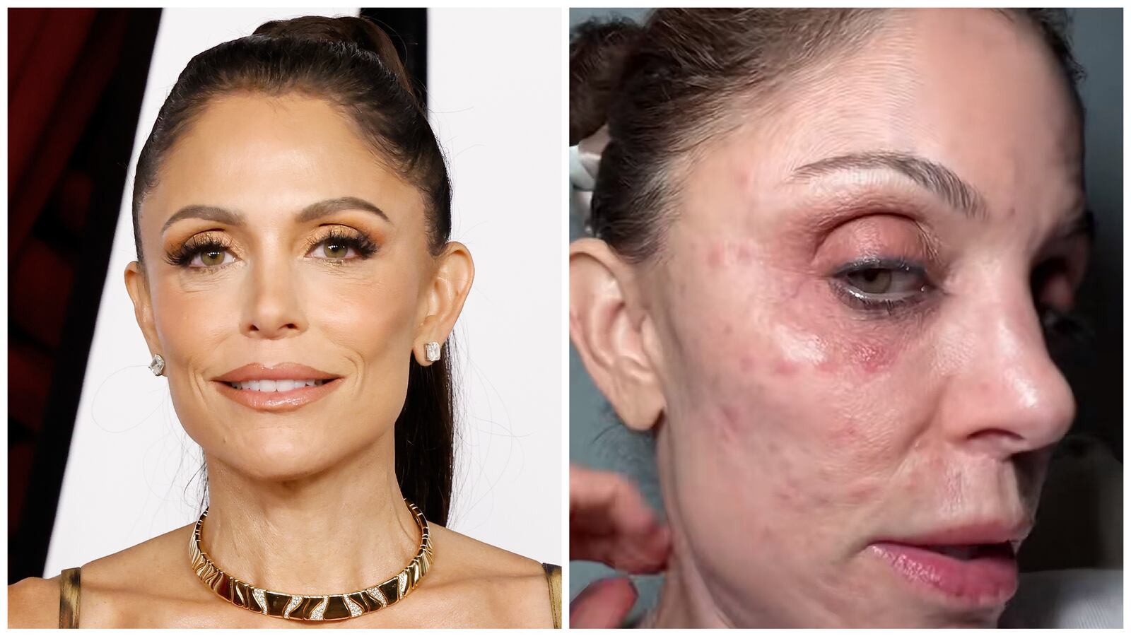 Bethenny Frankel