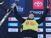 hunter hess