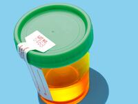 articles/2017/01/11/urine-isn-t-sterile-but-are-golden-showers-unhealthy/170111-warshaw-golden-showers-tease_tni4wd