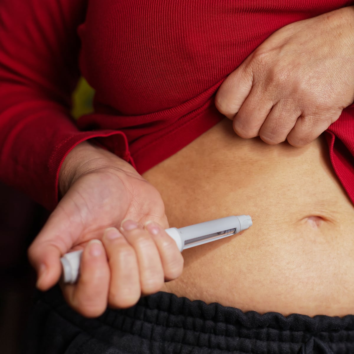 cramping after glp 1 shot Semaglutide Muscle Cramps: Why They Happen & Relief Strategies Stomach pinch on GLP-1? :