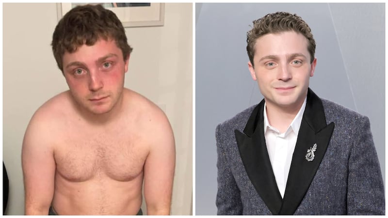 Jake Shane before/after