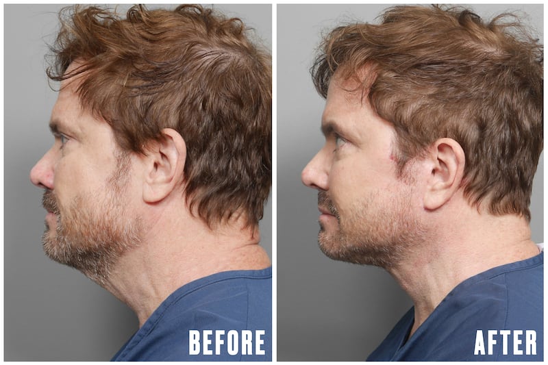 Why This Office Wardrobe Staple Is Driving Men to Get Plastic Surgery for The Looker