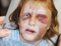articles/2014/10/20/the-worst-question-for-abuse-victims/141019-shire-private-violence_tf3us4