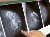 articles/2012/09/24/5-highlights-of-the-new-breast-cancer-study/breast-cancer-study-crocker_yl8rhu