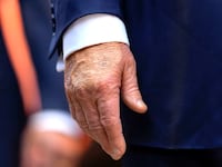 Make-up covers the back of the right hand of U.S. President Donald Trump during a tour of the Federal Reserve Board building in Washington, D.C., U.S., July 24, 2025. In a July 17, 2025 press briefing, U.S. Press Secretary Karoline Leavitt read a statement from his doctor that President Trump has a chronic venous insufficiency. REUTERS/Kent Nishimura