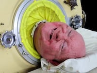 Paul Alexander, nicknamed 'the Man in the Iron Lung', has died at 78.