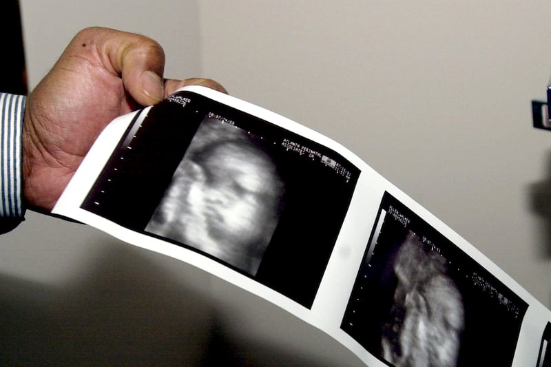 articles/2012/05/30/ronald-reagan-the-silent-scream-and-the-slow-rise-of-fetal-pain/fetus-pain-fight-yarrow_cdg8mq