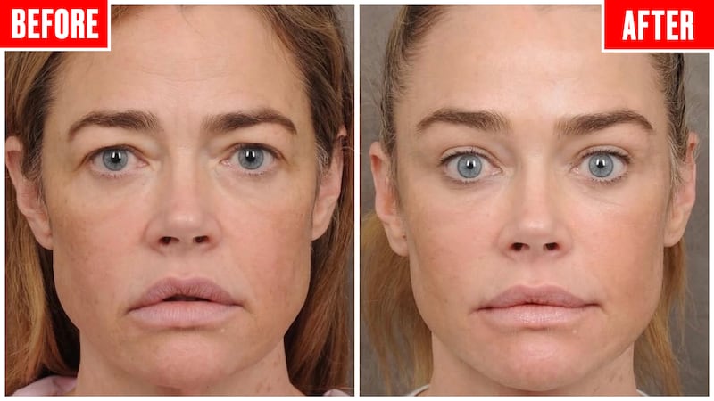 Denise Richards, Before and After