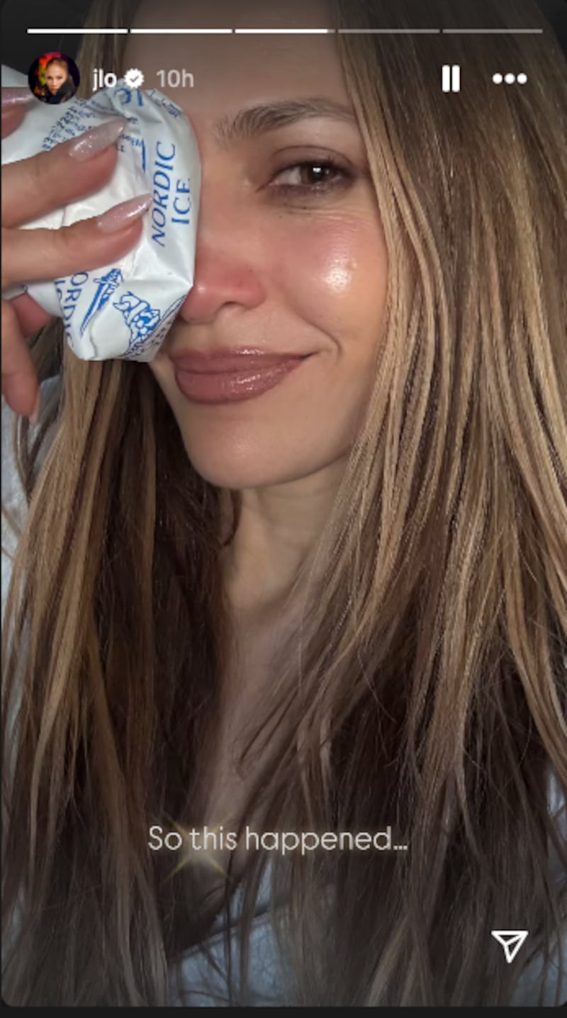 An Instagram photo of Jennifer Lopez icing her nose and face.
