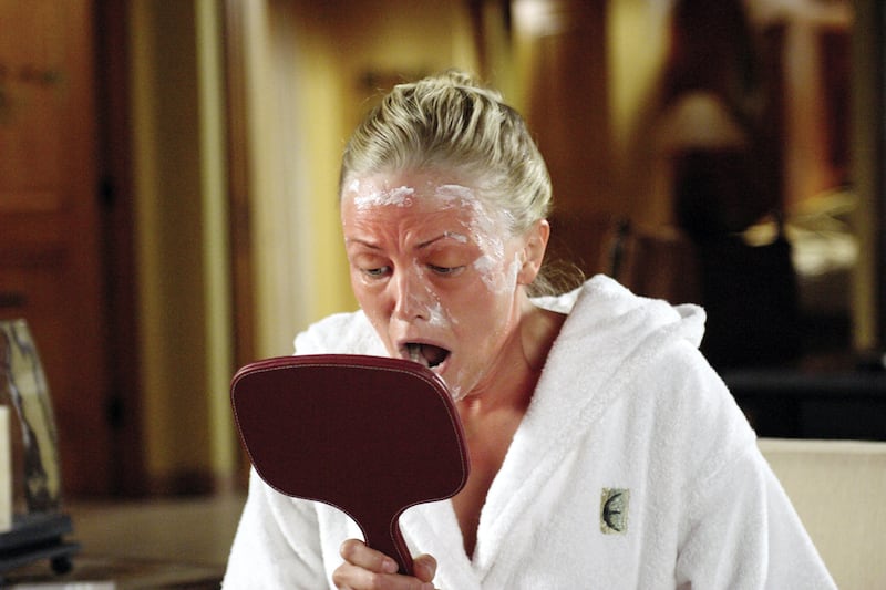 galleries/2011/07/04/celebrity-sunburns-kim-kardashian-simon-cowell-and-more/ackerman-worst-celebrity-sunburns_piiiuw