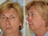 croatia_erzym3