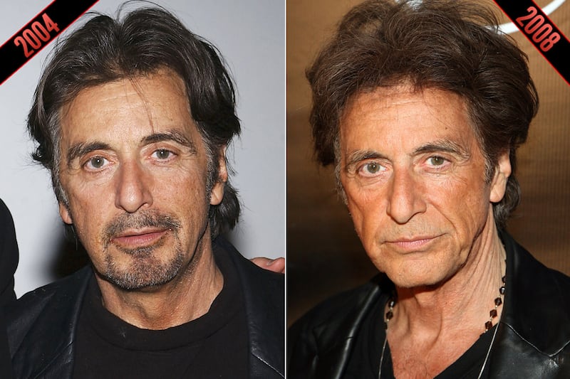 galleries/2011/10/05/simon-cowell-steve-martin-male-stars-rumored-plastic-surgery-photos/plastic-surgery-al-pacino-2_rketib