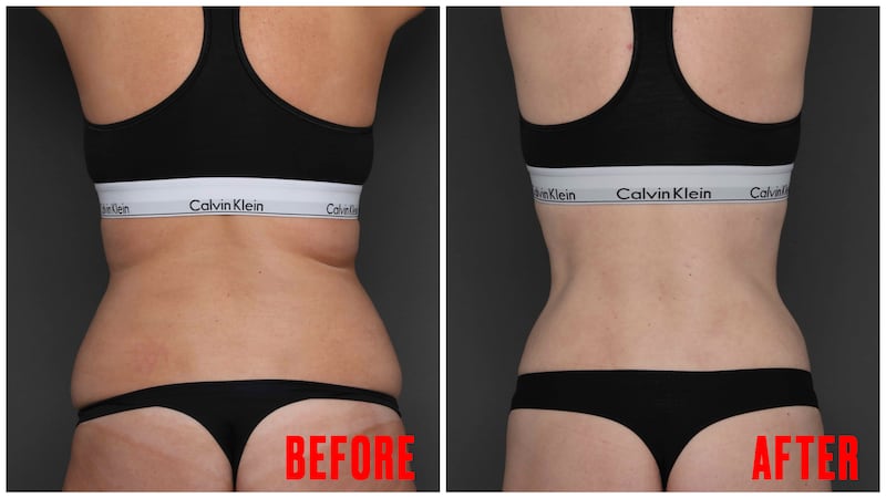 Body Transformation before and after images