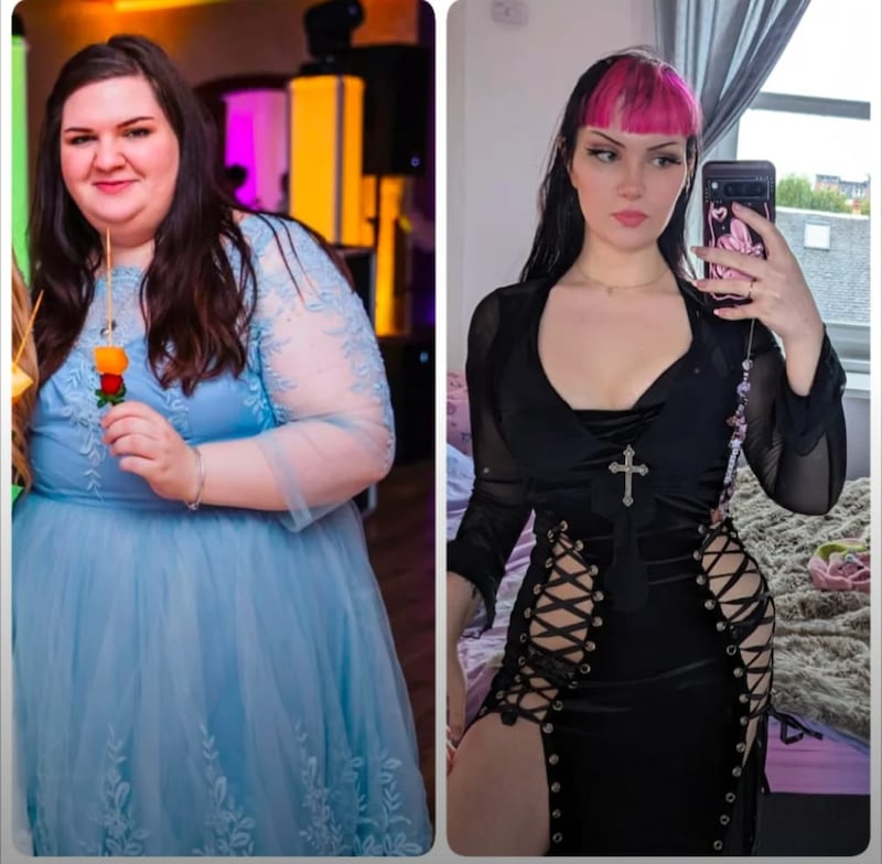 A before-and-after of the subject. Winter had a total of ten cosmetic surgeries to fix her body dysmorphia.