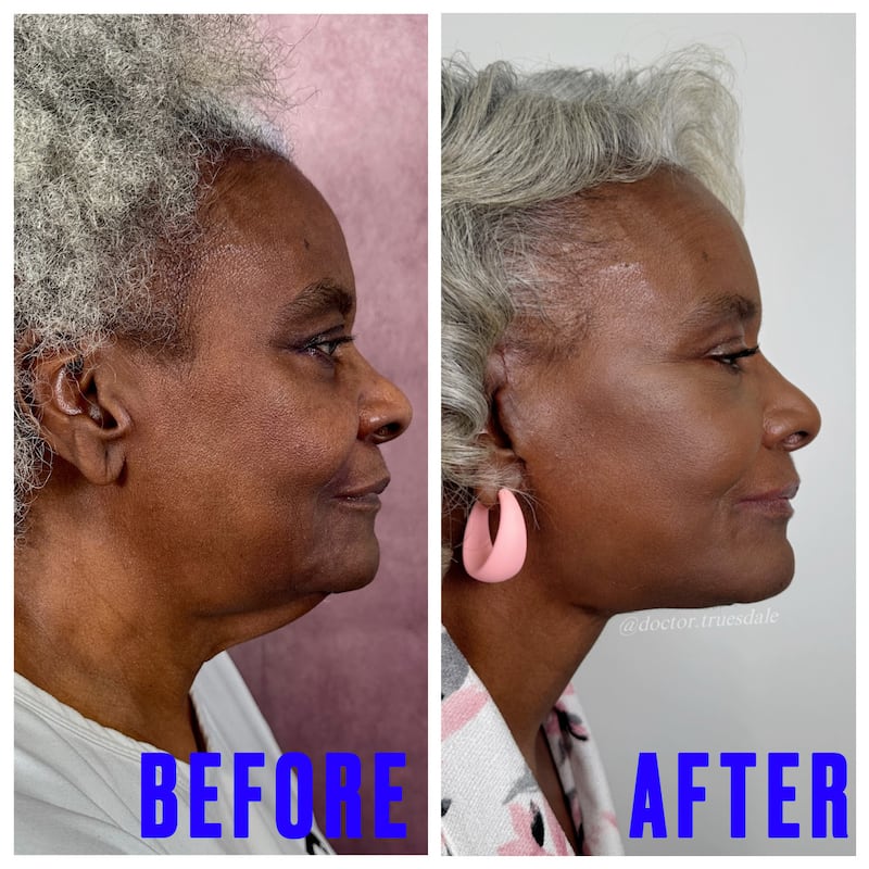 For The Looker - This Surgeon Gave His Mother a Facelift and the Results Went Viral