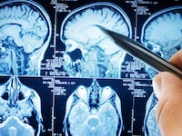 articles/2015/03/05/scientists-can-now-read-your-memories/150304-lytton-alzheimers-tease_ubid6b