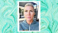 Looker - A 20-Minute Treatment Completely Transformed This Woman's Skin