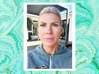 Looker - A 20-Minute Treatment Completely Transformed This Woman's Skin