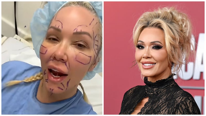 Bunnie Xo before surgery (left); Bunnie Xo on the red carpet