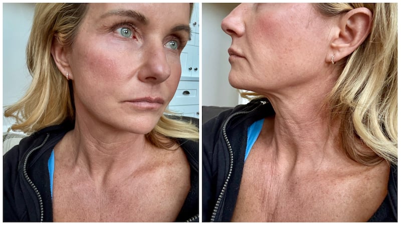 Chari Pack wanted to address her neck with plastic surgery.