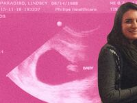 articles/2016/10/26/she-put-her-late-term-abortion-on-facebook-to-prove-donald-trump-wrong/161025-zavadski-late-term-abortion-2_pudp6h